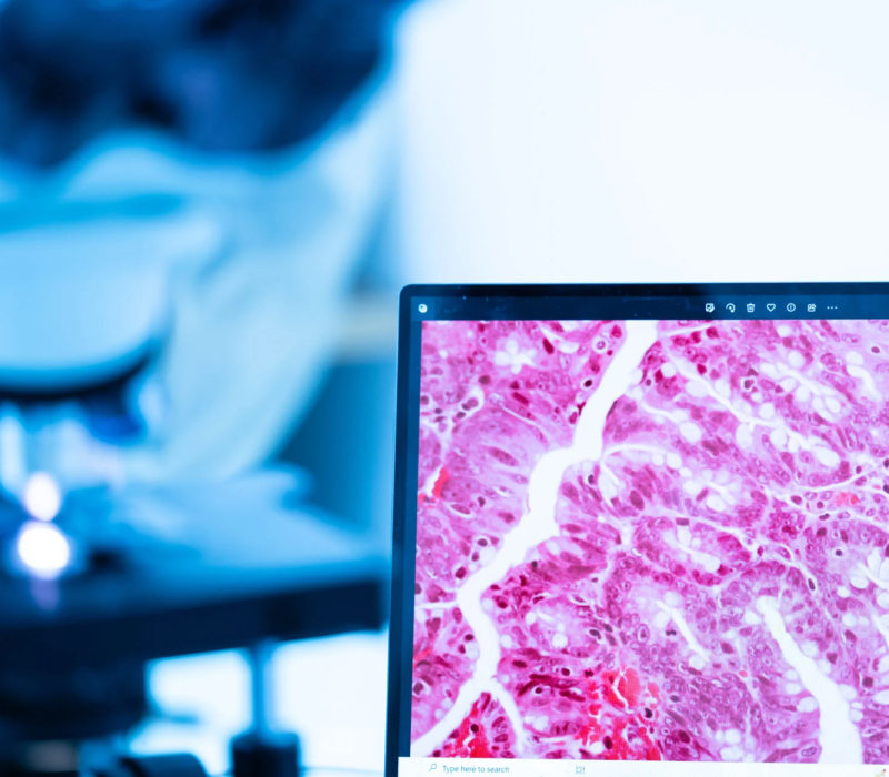 Computer screen in a lab showing health data