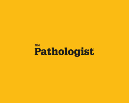 Can Digital Pathology Improve Risk Stratification After Prostatectomy?